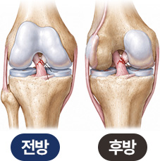 전방 | 후방