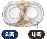외측 | 내측