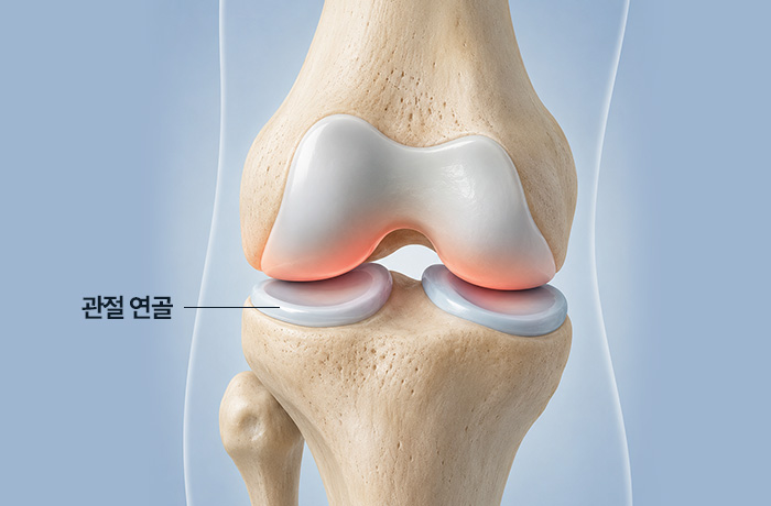 관절 연골